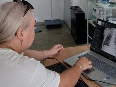 Понад 8,3 тисячі жителів Херсонщини пройшли обстеження на туберкульоз - Херсон Daily