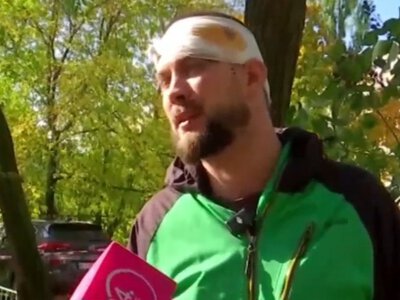 Повернувся з фронту й потрапив під ракетний удар у рідному Києві: наслідки
