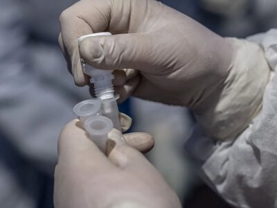 Новий спалах небезпечної інфекції в РФ: росіян ізолюють через віспу мавп