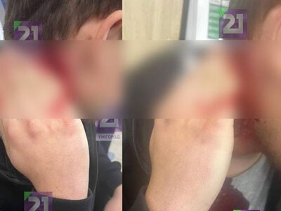 В Ужгороді конфлікт між підлітками закінчився різаниною