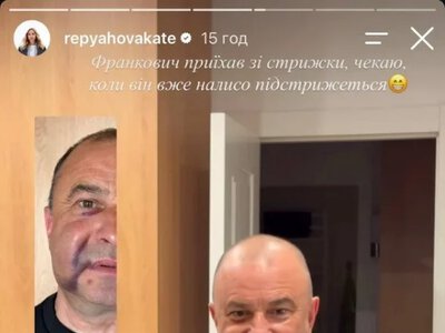 Дружина співака з Тернопільщини показала його обличчя з жахливим набряком і гематомою після невдалої операції