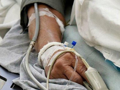 У Франції людина померла від вірусу, який вважали безпечним для людини