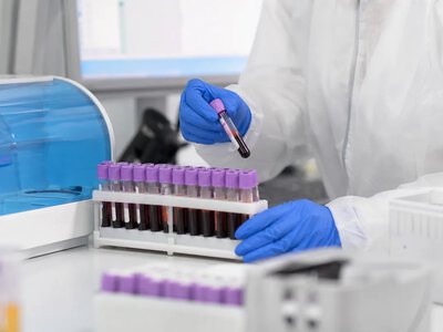 У США виділили 41 млн доларів на випробування профілактики Альцгеймера