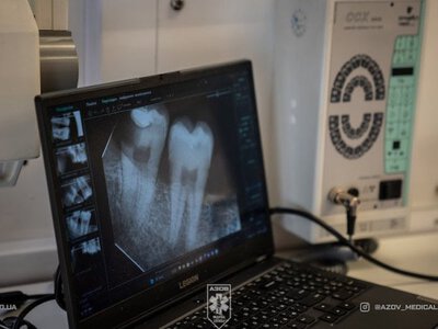 Стоматологічні наслідки полону: чи вважається безоплатна реабілітація наданою, якщо людина досі не може говорити і жувати?