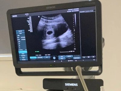 У Львові відкрили Центр жіночого здоров’я: які послуги там надаватимуть
