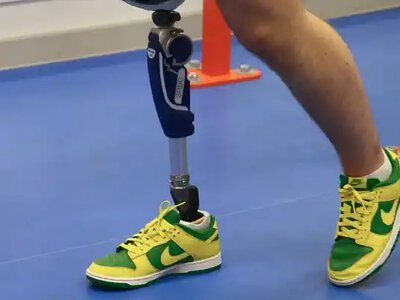 Росія більш ніж уп’ятеро збільшила імпорт протезів кінцівок із Німеччини на тлі втрат у війні проти України