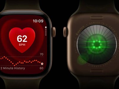 Сповіщення Apple Watch про високий пульс допомогло жінці вчасно звернутися до лікарів