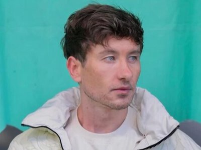 Баррі Кеоган зробив косметичну процедуру для підтяжки шкіри після цькування через зовнішність